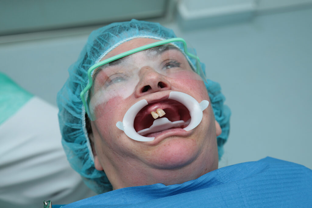 Ouvinte da Rádio Alto Minho ganha um novo sorriso com a marca “Dental”