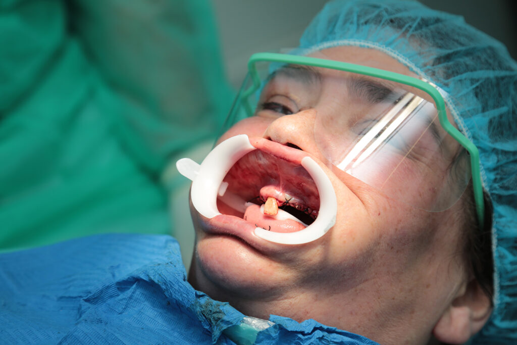 Ouvinte da Rádio Alto Minho ganha um novo sorriso com a marca “Dental”