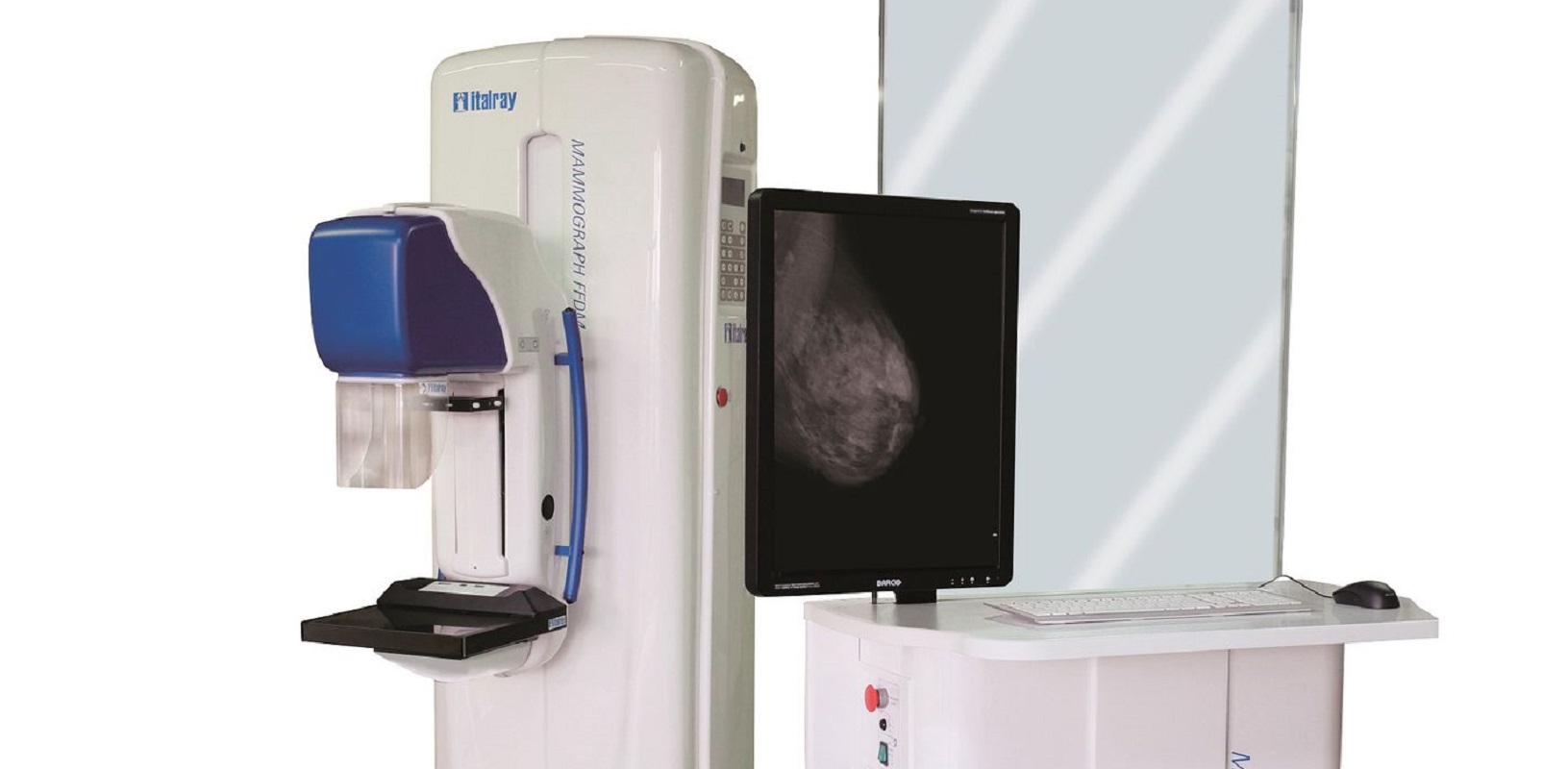 Campanha da Liga dos Amigos do Hospital de Viana quer juntar 100 mil euros para novo mamógrafo