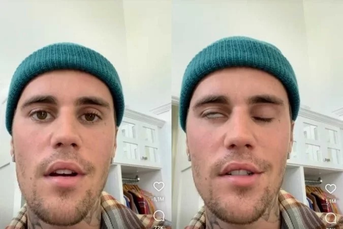 c/VÍDEO: Justin Bieber cancela concertos de digressão internacional devido a paralisia facial