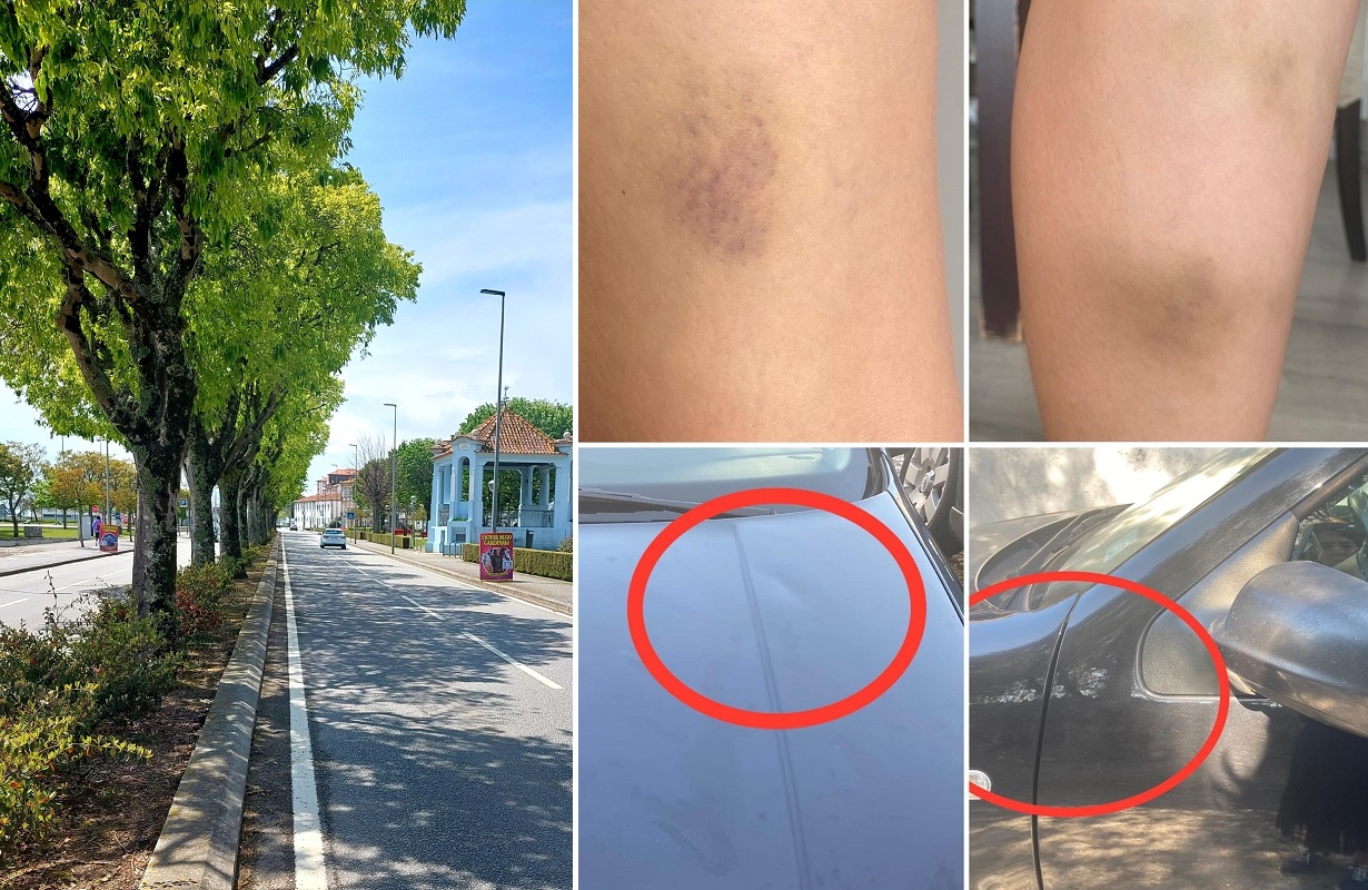 Mulher foi “barrada” e “agredida” por outras duas em Viana do Castelo