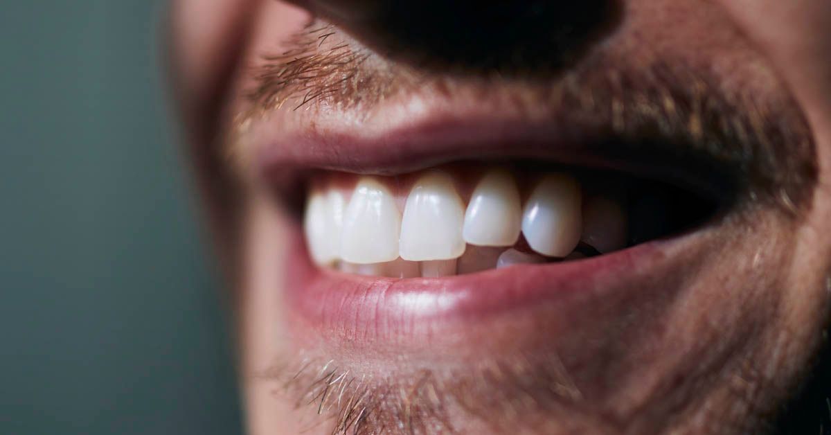 A importância de corrigir o apinhamento dental em adultos